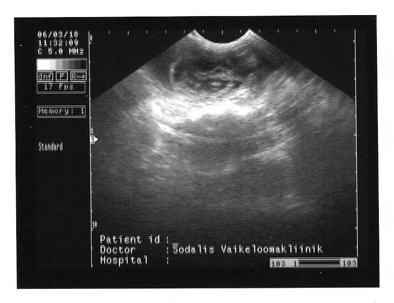 Abdominal ultrasound Felallo-Fulu Maasik 06.03.2018